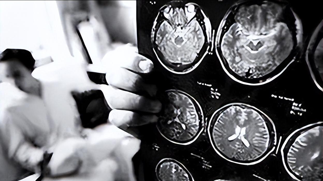 小孩检查脑ct有危害吗,年龄大了查血查什么好