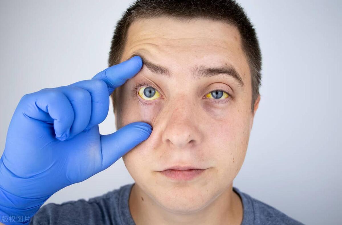 直肠癌晚期可能会有哪些临床表现?