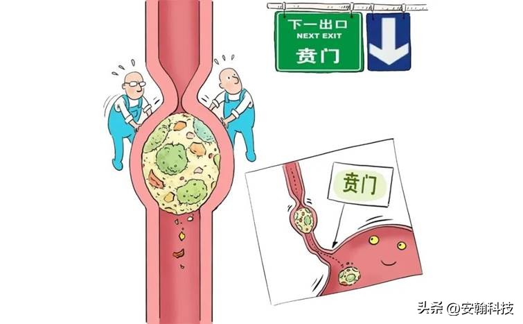 安翰科技磁控胶囊胃镜怎么检查,安翰磁控胶囊胃镜能检查清楚吗