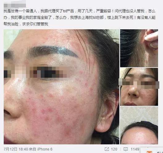 张庭夫妇传销大曝光,张庭夫妇怎么传销了