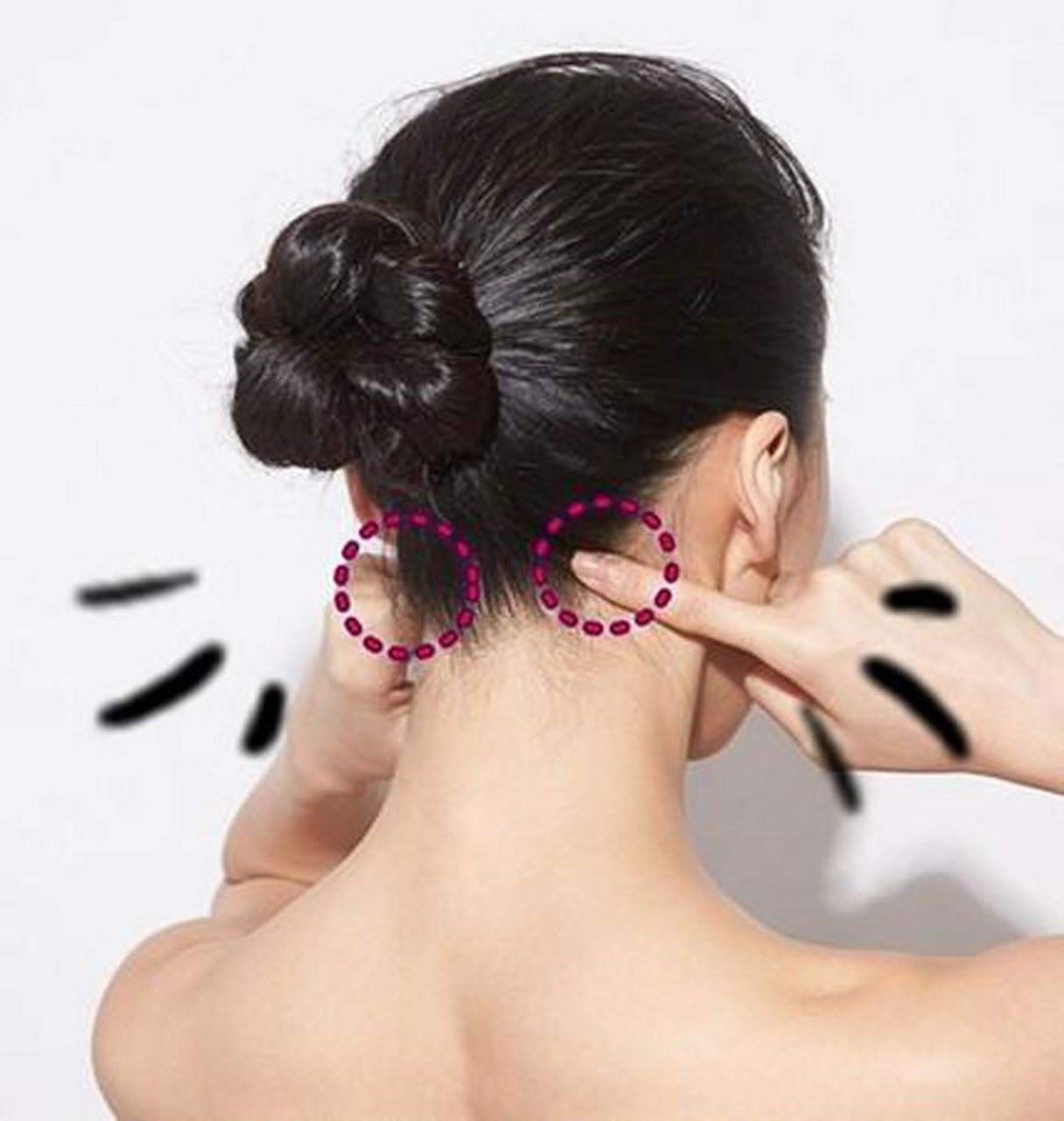 中医针灸治疗颈椎病原理,颈椎病针刀按摩针灸哪种方法好