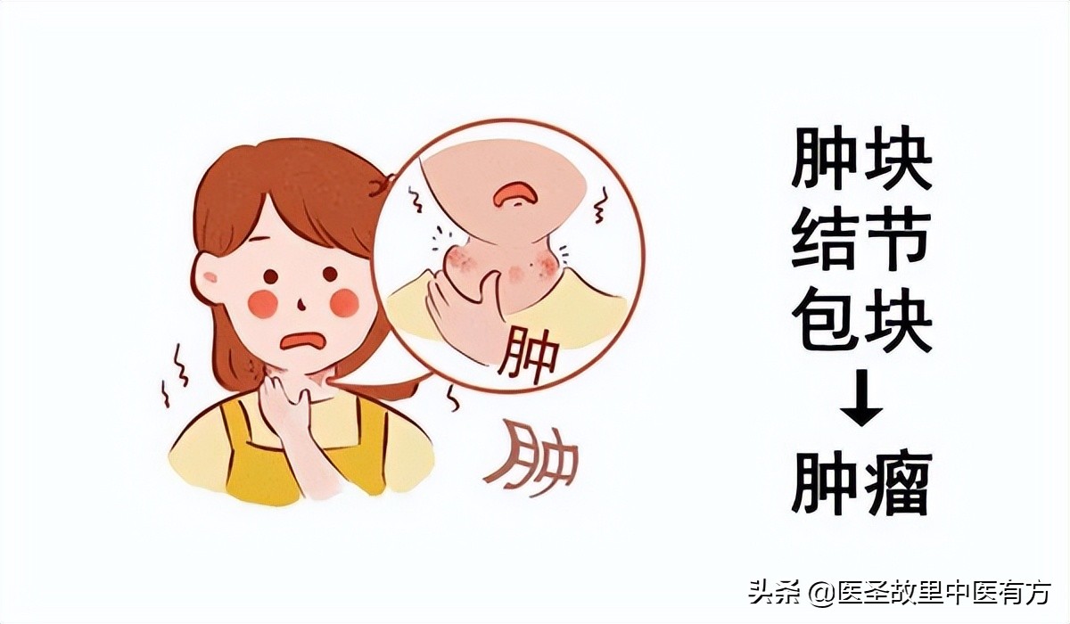 痰湿三味中药克星,治疗痰湿结节包块的一张秘方