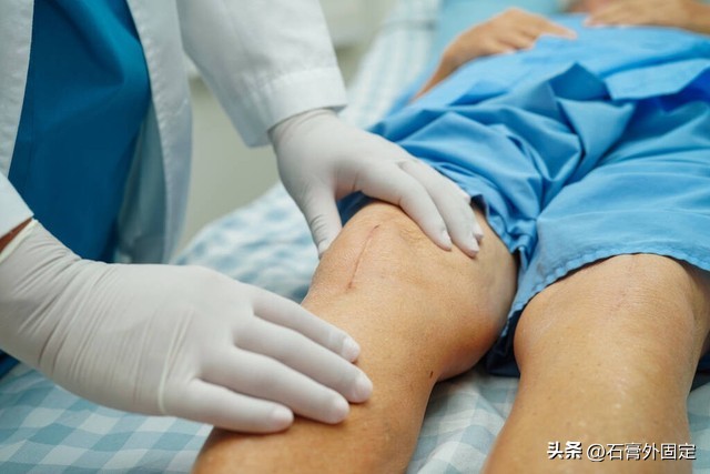 膝关节置换10年后注意什么,膝关节半月板置换后注意事项