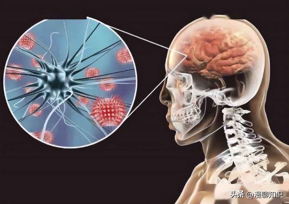 不同地区的细菌性脑膜炎发病率差异性很大，发达国家低，而非洲高