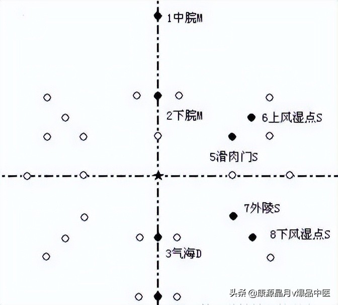 腹针疗法及16例常用处方