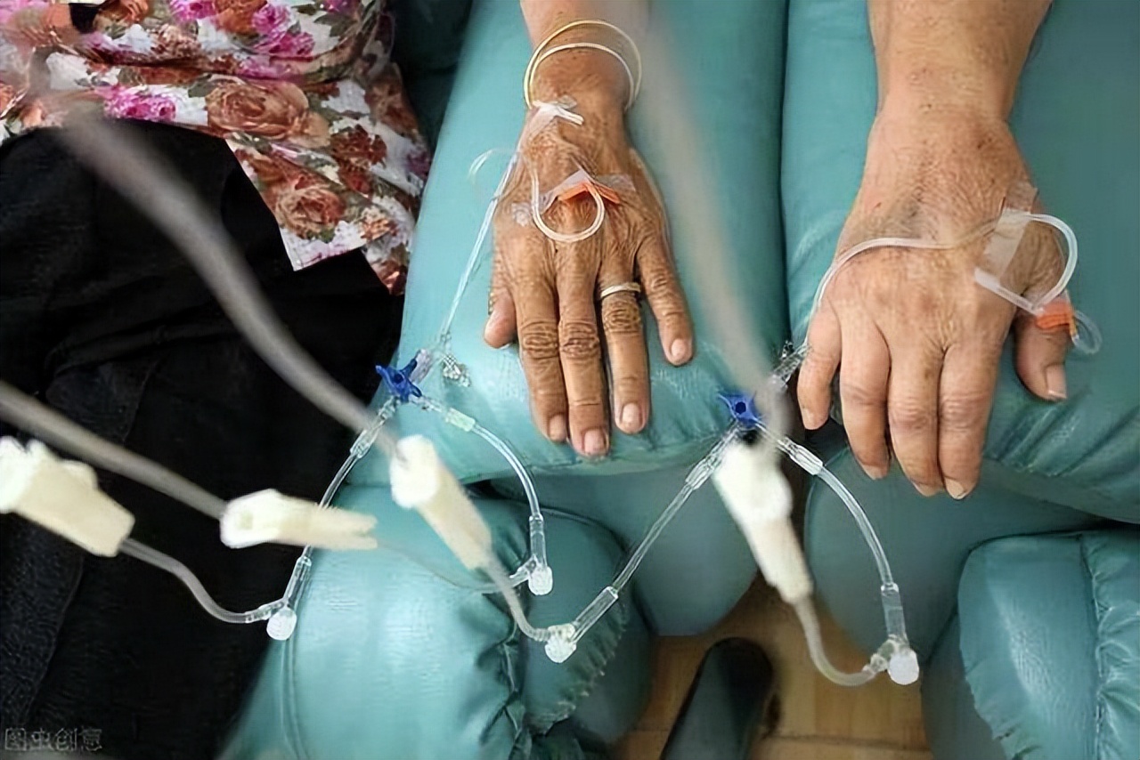 发现癌症不能动手术,发现癌症不治疗会怎样