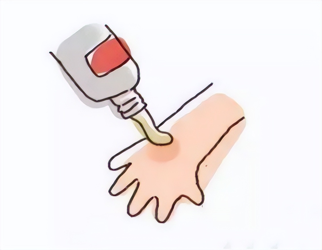 医生：2块钱一支的红霉素软膏不是万能药，别乱用