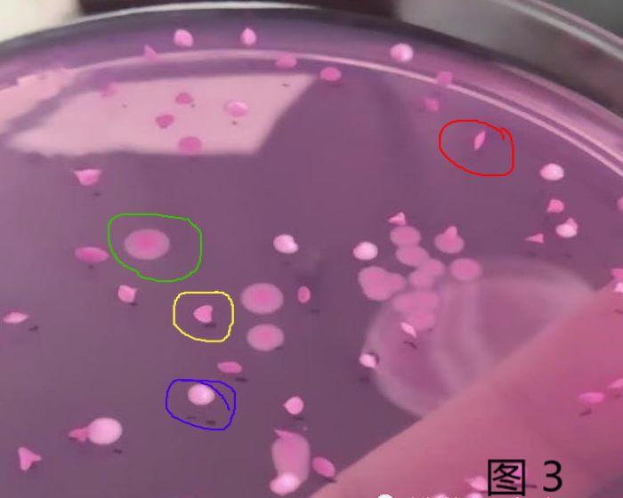 霉菌酵母菌检测方法视频,霉菌检验方法步骤