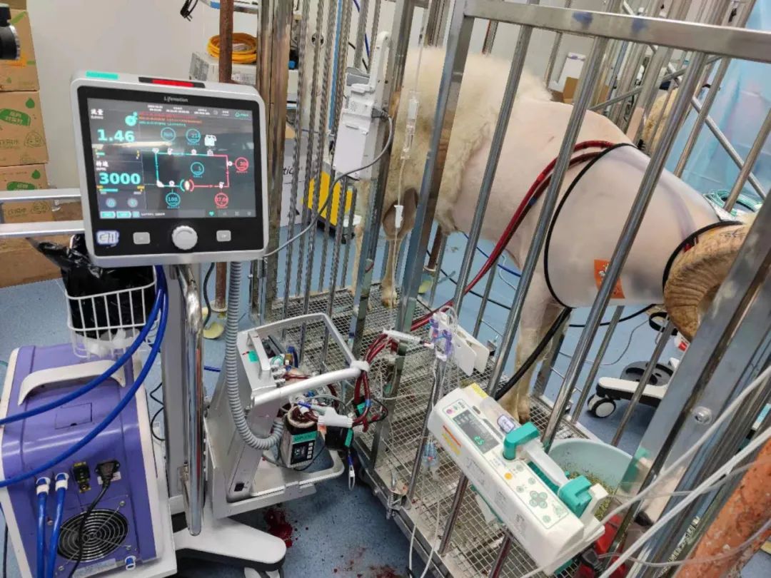 国产首款ecmo研发成功的意义,国产首个ecmo产品是哪家公司的