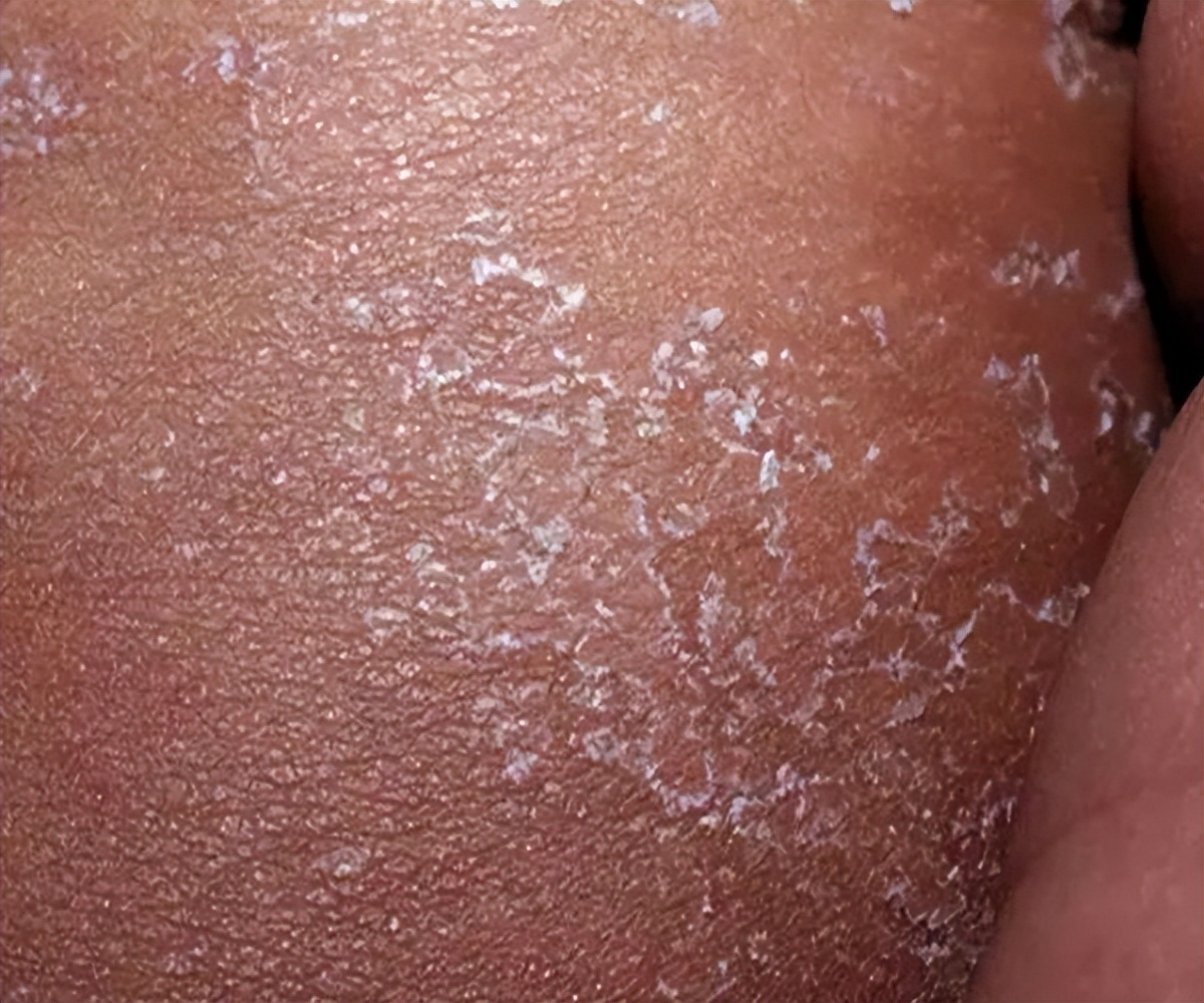 小孩的舌头出现小红点点,小儿舌头的各种症状如何解决