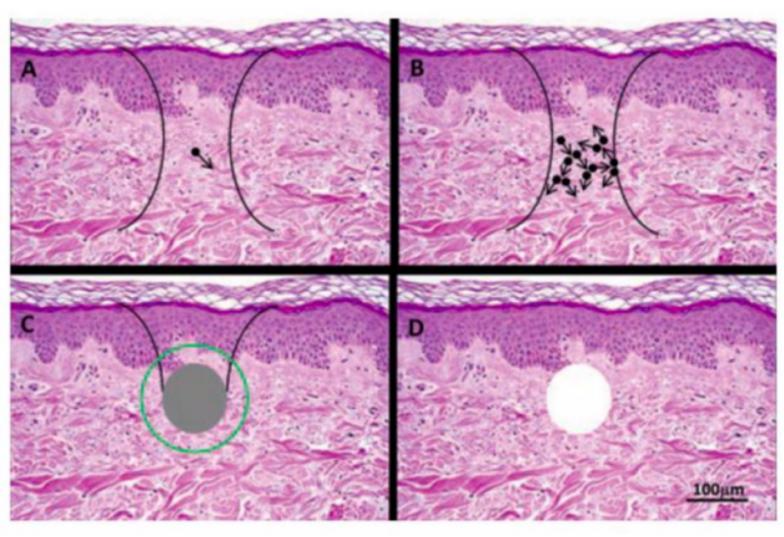 遮瑕色斑化妆的正确步骤教程,干性皮肤脸上有色斑怎么遮瑕