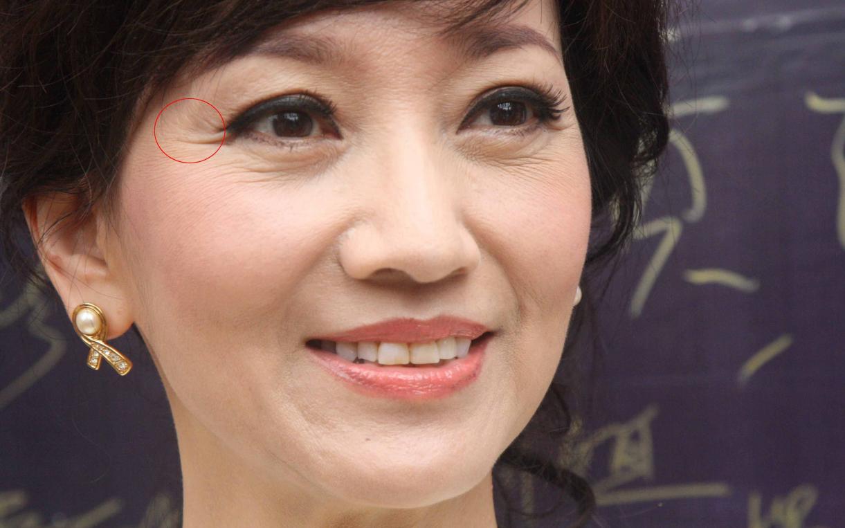 什么是鱼尾纹,有了鱼尾纹该如何补救