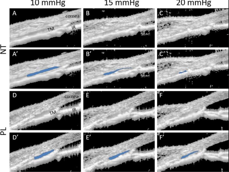 rho激酶抑制剂多少钱,rho激酶抑制剂是什么