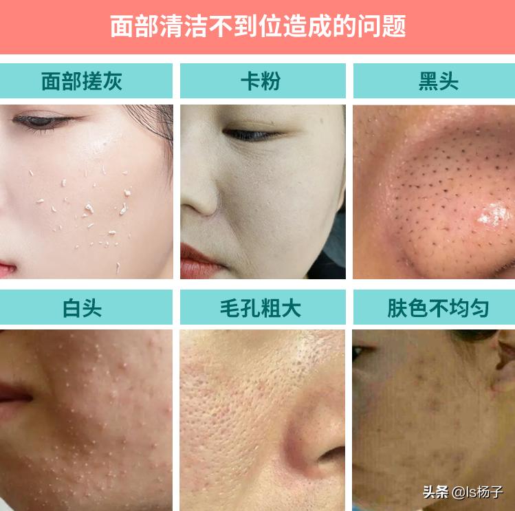 脸部怎么清洁最干净零成本,脸部怎样做深层清洁