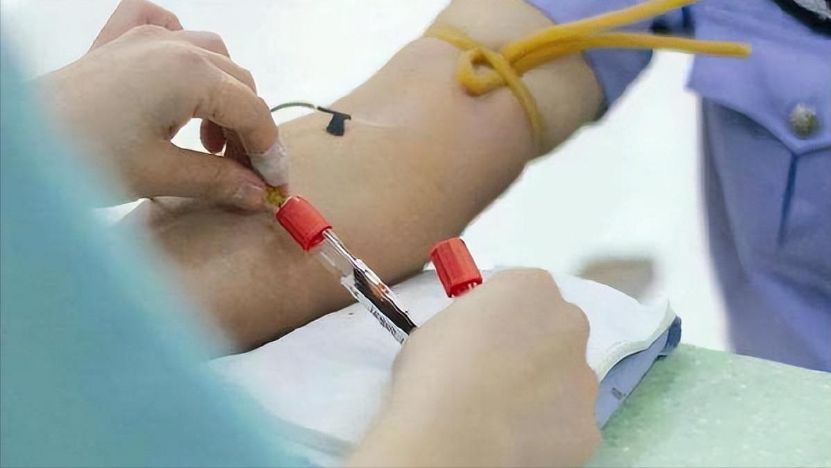 李鑫高考状元,清华糖友李鑫