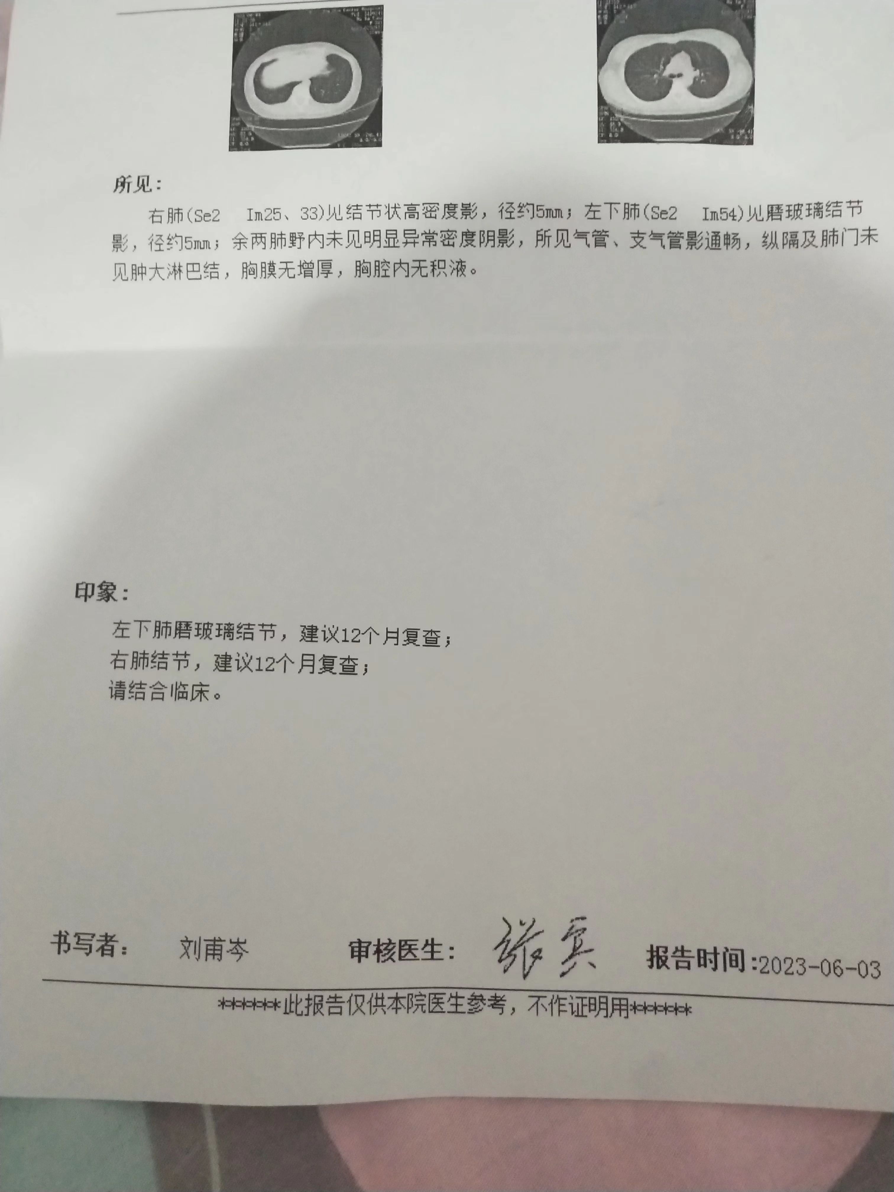 肺部ct报告单中写着阳是什么意思,关于肺部CT报告常见的6个问题