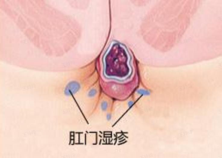 你有洗屁股的习惯吗,你有洗冷水澡的习惯吗