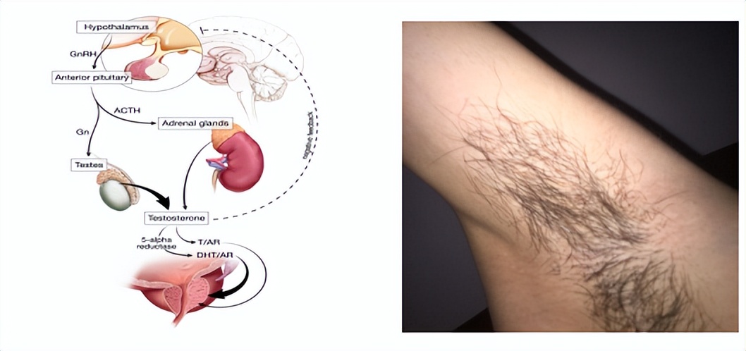 男性青春发育迟缓的表现,生长迟缓的烦恼