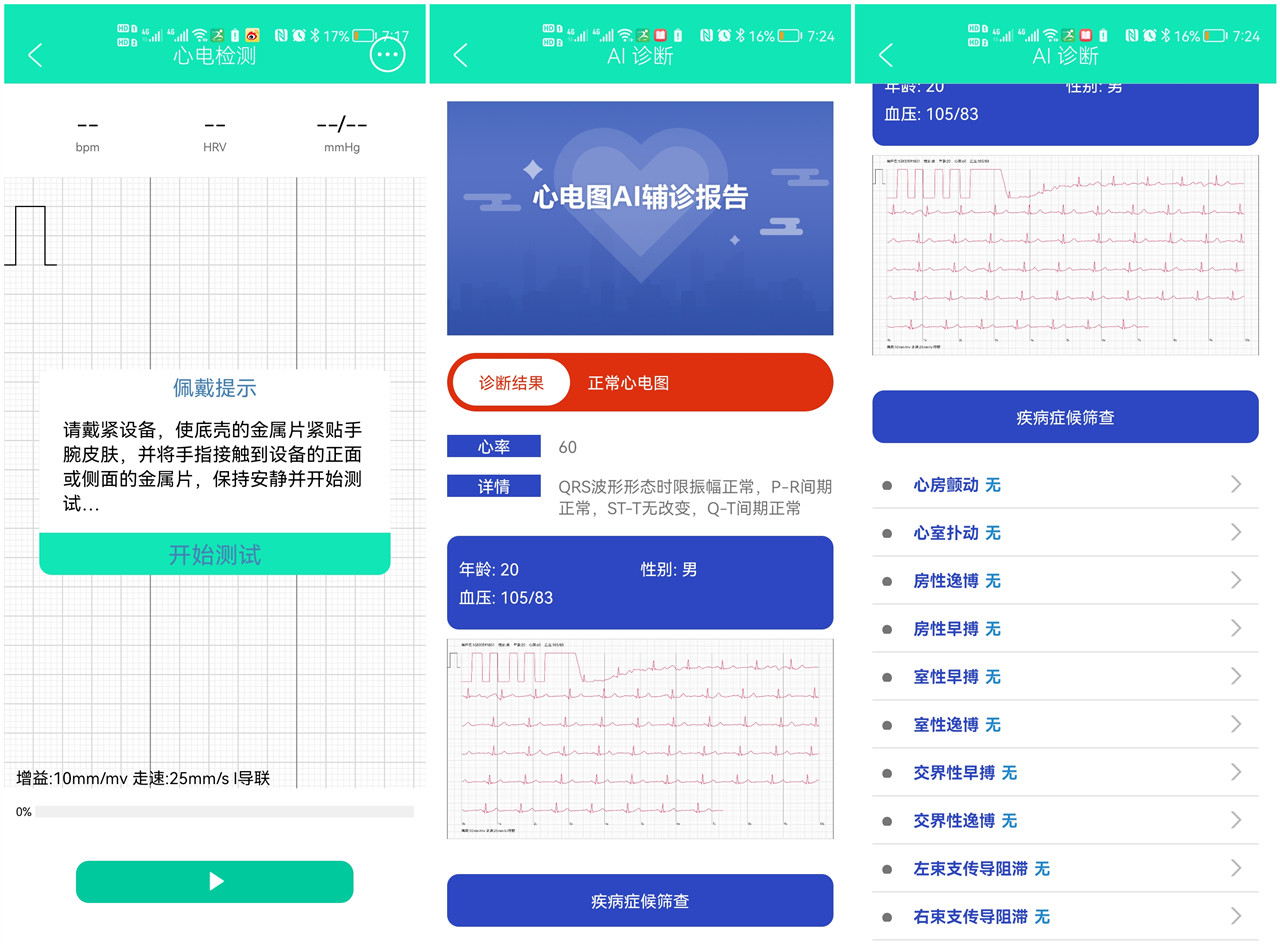 didoe10智能手表测量准吗,dido手表