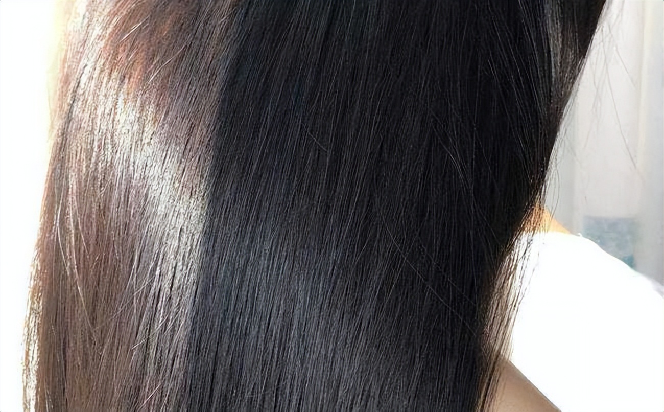 肝肾阴虚须发早白中医怎么治,精血不足须发早白辨治秘方