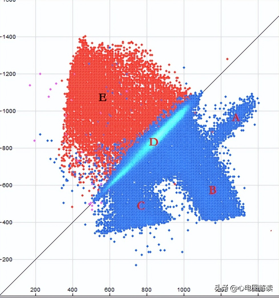 可见室性融合波是什么意思,室性融合波什么意思