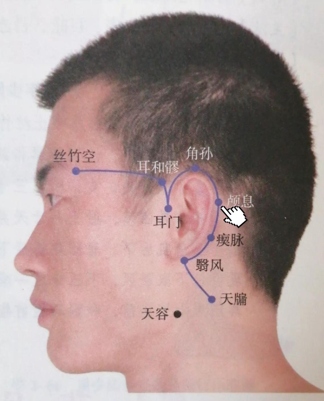 每日一穴膈关穴,颅息穴进针视频