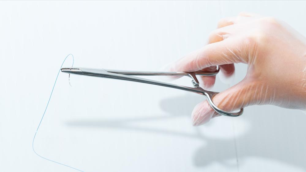 检查胎儿外阴肥大,宝妈说孩子检查出腺体肥大