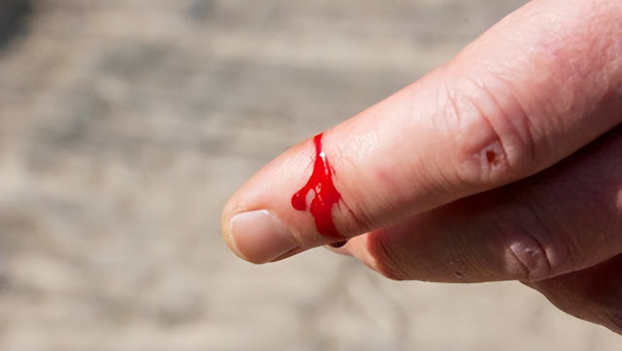 手术后刀疤又出血正常吗,手术后少量出血会影响伤口愈合吗