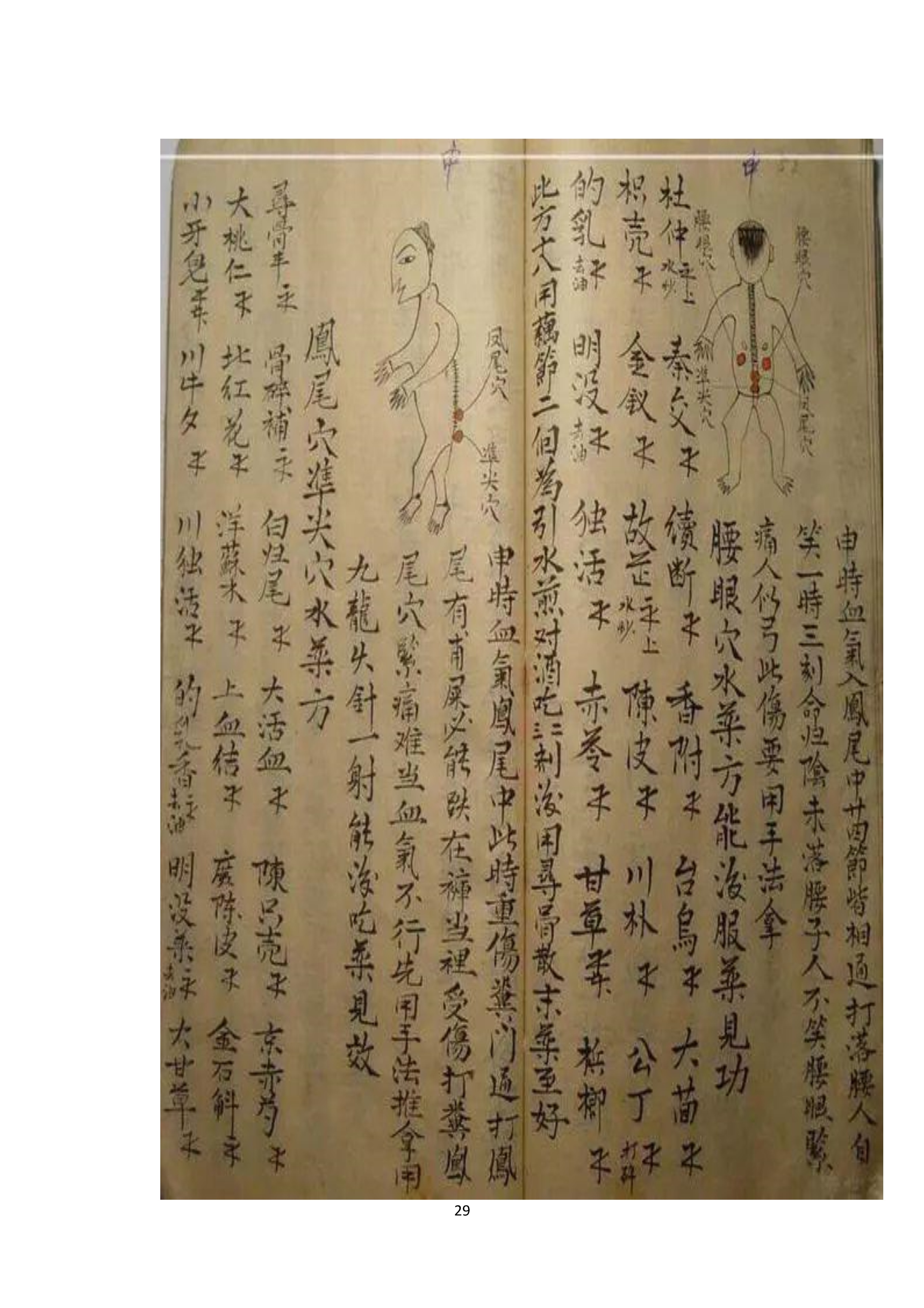 中医古书籍清代带图且内容非常好的手抄跌打损伤良方