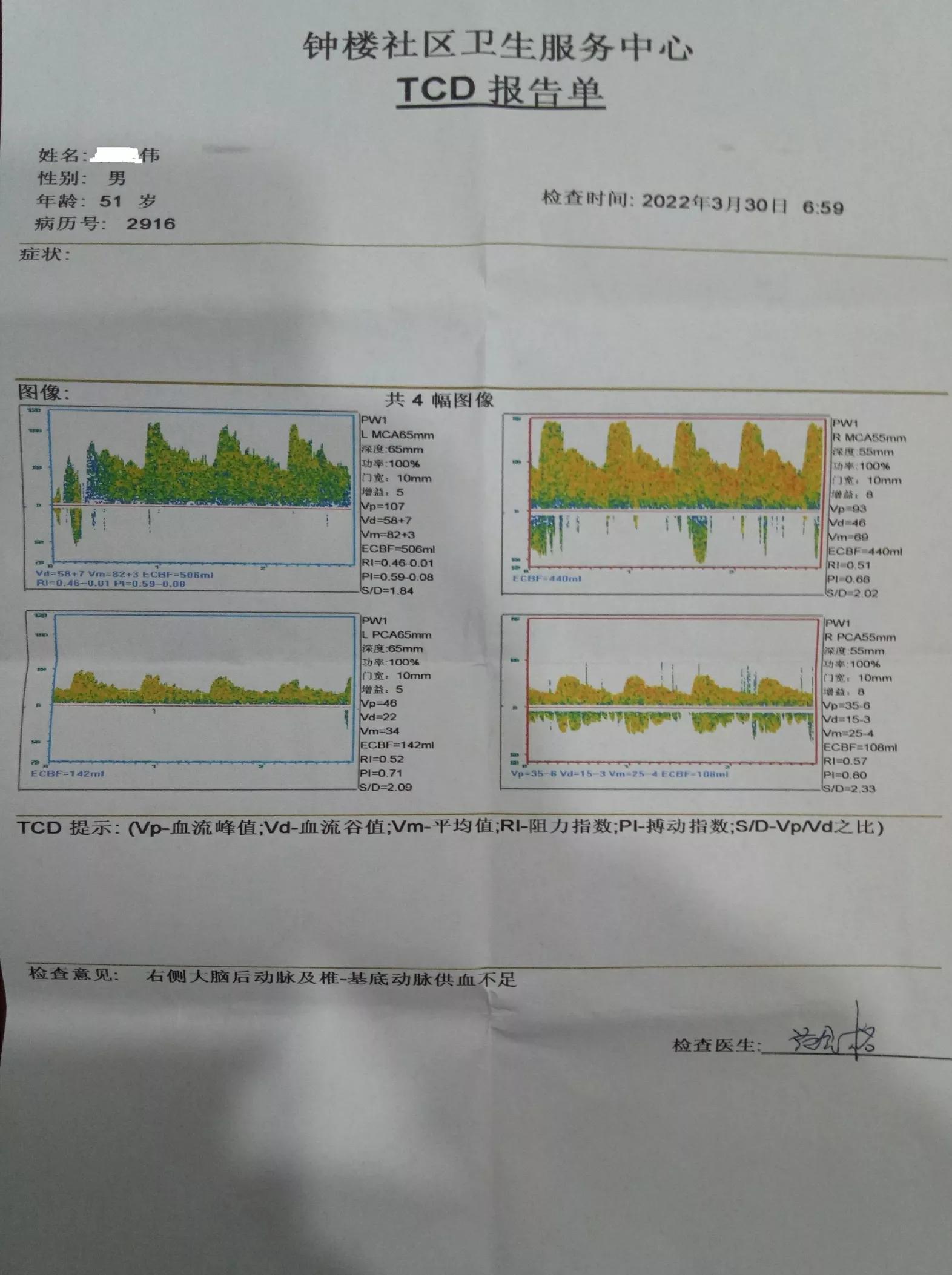 脑供血不足血压低建议住院,高血压短暂脑供血不足的症状