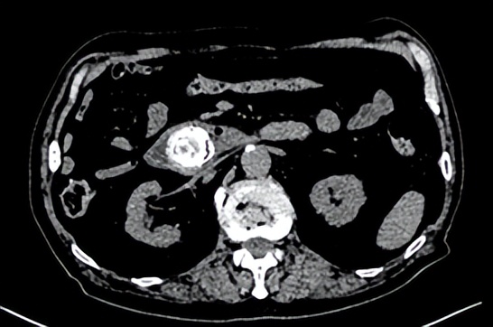 哈医大一院群力院区能体外碎石吗,哈医大一院激光科