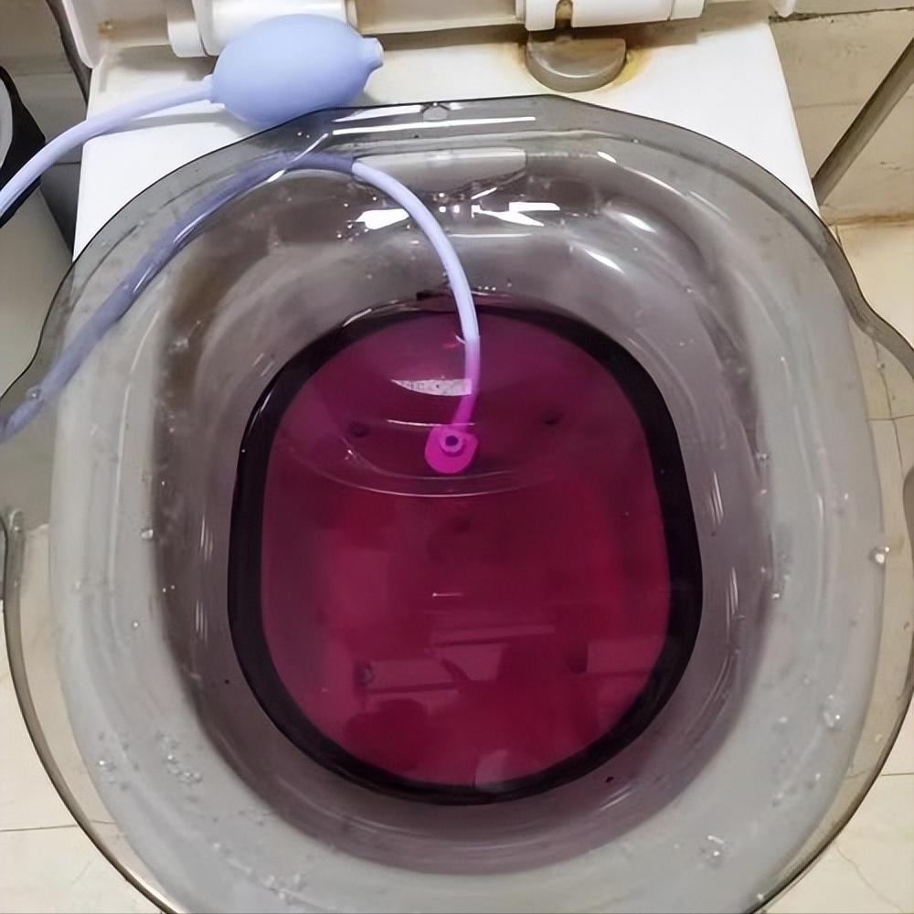 使用痛痒消洗剂治疗混合痔患者术后创面水肿，在临床上疗效如何？