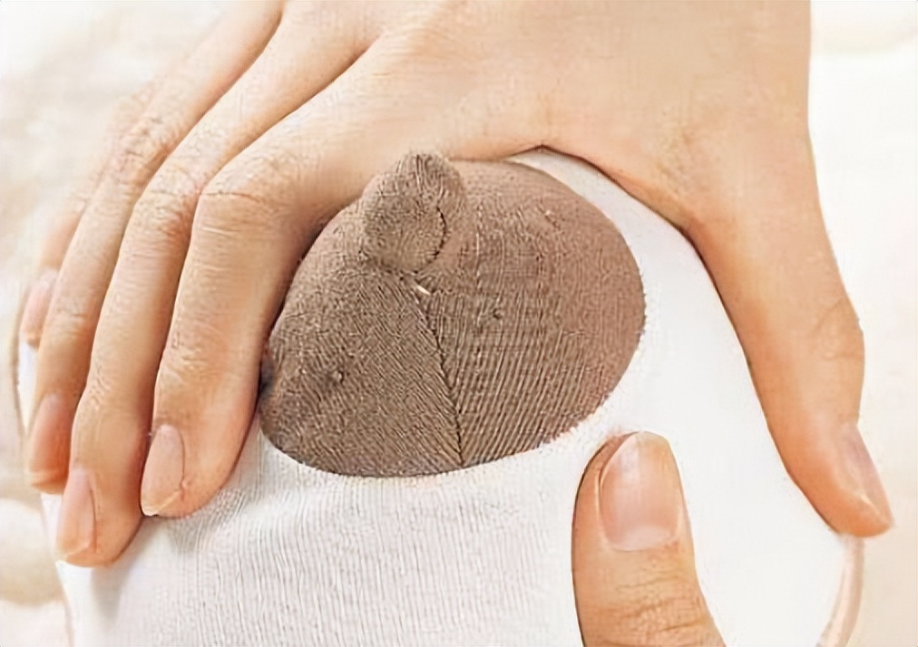 乳晕长了小疙瘩,正常吗?难不成是乳腺癌