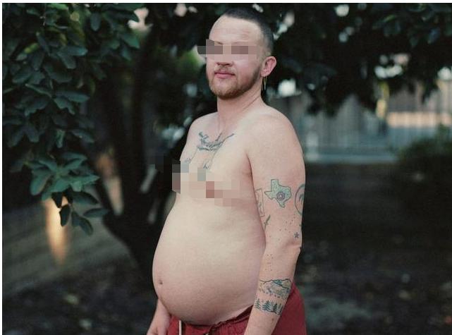 繁衍背后阴暗面,双性人逐年增加!都是为生男孩服下转胎丸惹的祸