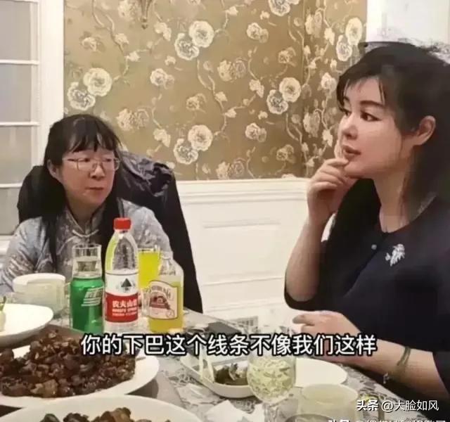 苹果姐姐整容手术,苹果姐姐做整容手术