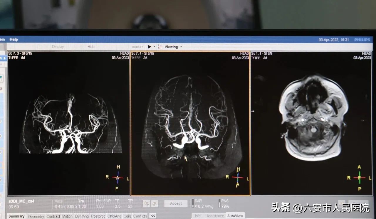 重磅！PHILIPSINGENIA3.0TCX磁共振在六安市人民医院西院区启用