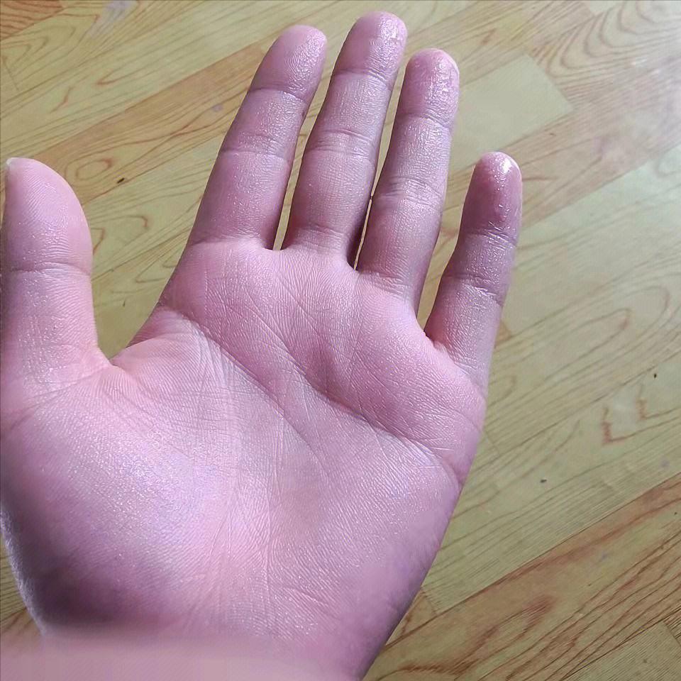 手老是出汗感觉湿湿的,为什么手和脚老是出汗