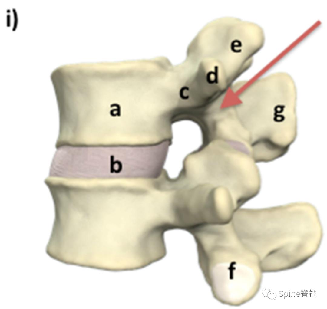 峡部裂和隐性峡部裂有区别吗,单纯峡部裂可以做峡部修复吗