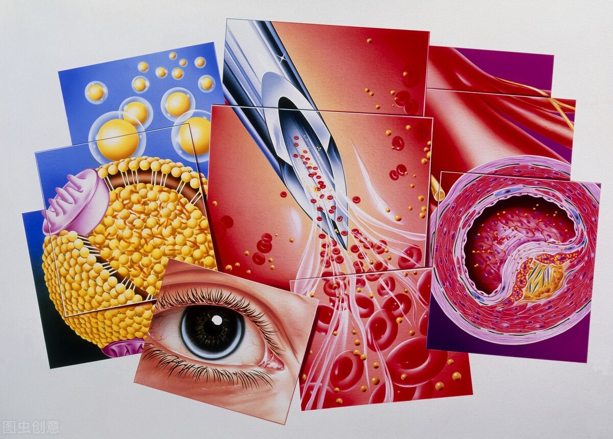 请问医生血脂高饮食有哪些禁忌,二十几岁高血脂饮食注意事项