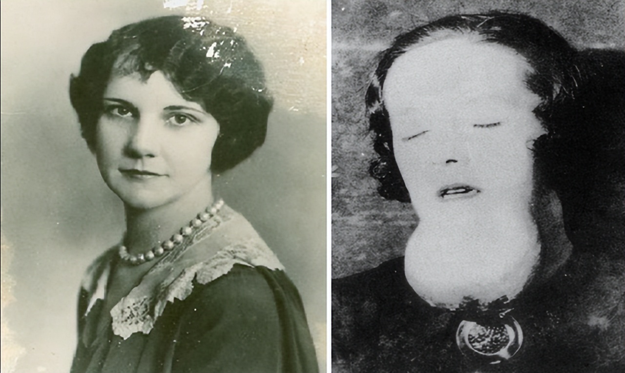 男子喝了1400瓶辐射水,男子喝核辐射水死后尸体发热