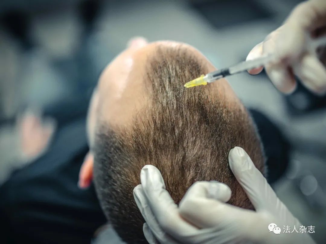 脱发群体年轻化趋势日益明显,脱发问题年轻化已然成为事实