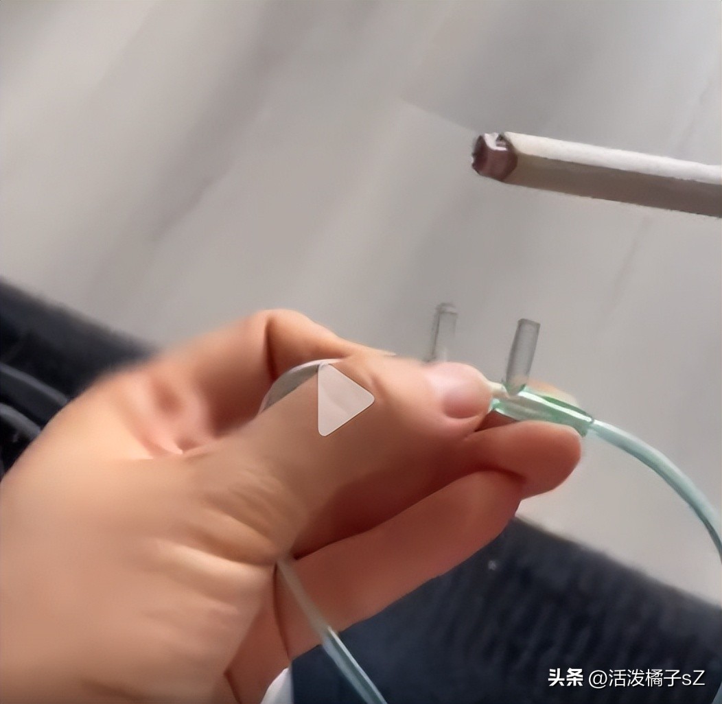 女子测试制氧机起火,制氧机把烟头点燃