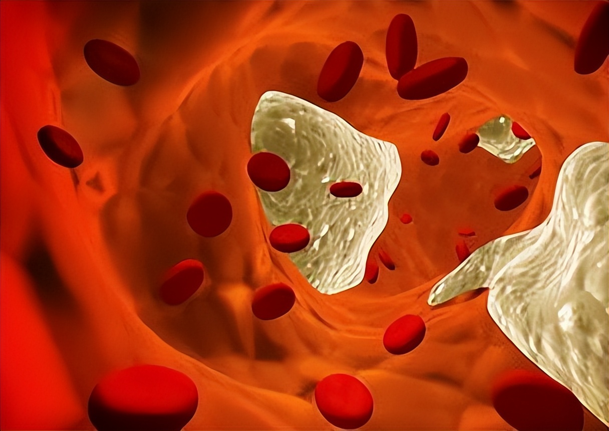 病从血中来是真的假的,中医调理心梗方法