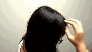 肾藏精，其华在发，中医助你“守住”发际线