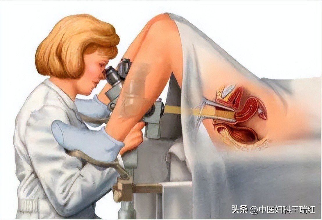 令女性患者闻之色变的阴道镜真有那么可怕吗？一文让你彻底了解它