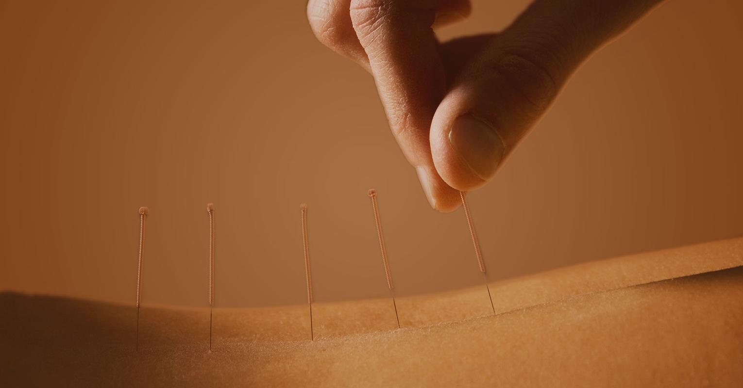 中医针灸治疗腰痛病的学术思想,古法针灸临床治验