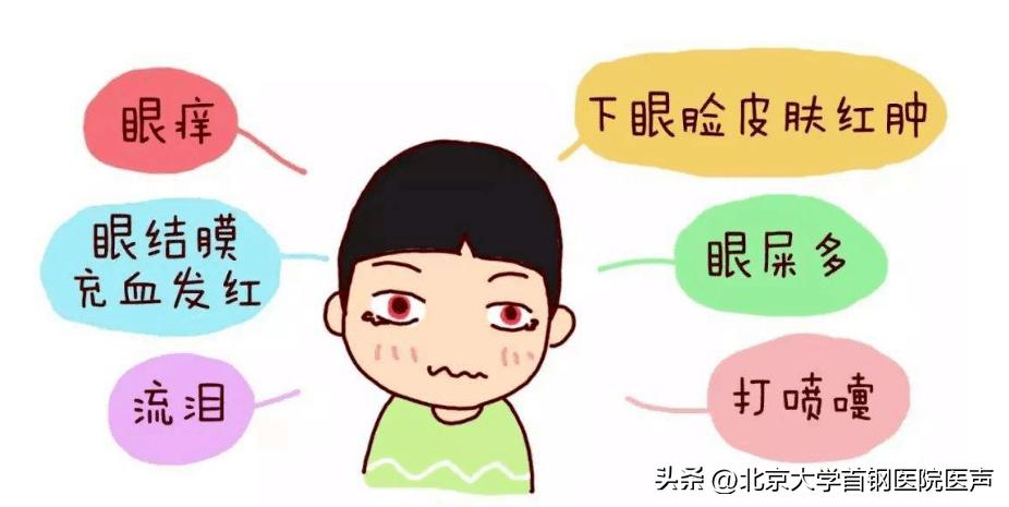 过敏性结膜炎引起的眼痒民间偏方,春季过敏性结膜炎科普视频