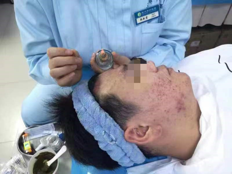 郑州市中医院皮肤科,深耕中医十年