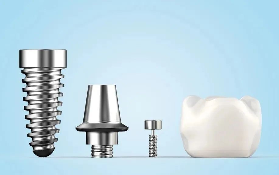 植得口腔种牙技术怎么样,植得口腔医院种植牙多少钱一株