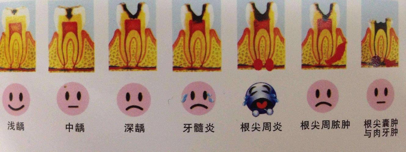 过年牙疼怎么办医生都不上班,老牙疼怎么办最有效方法